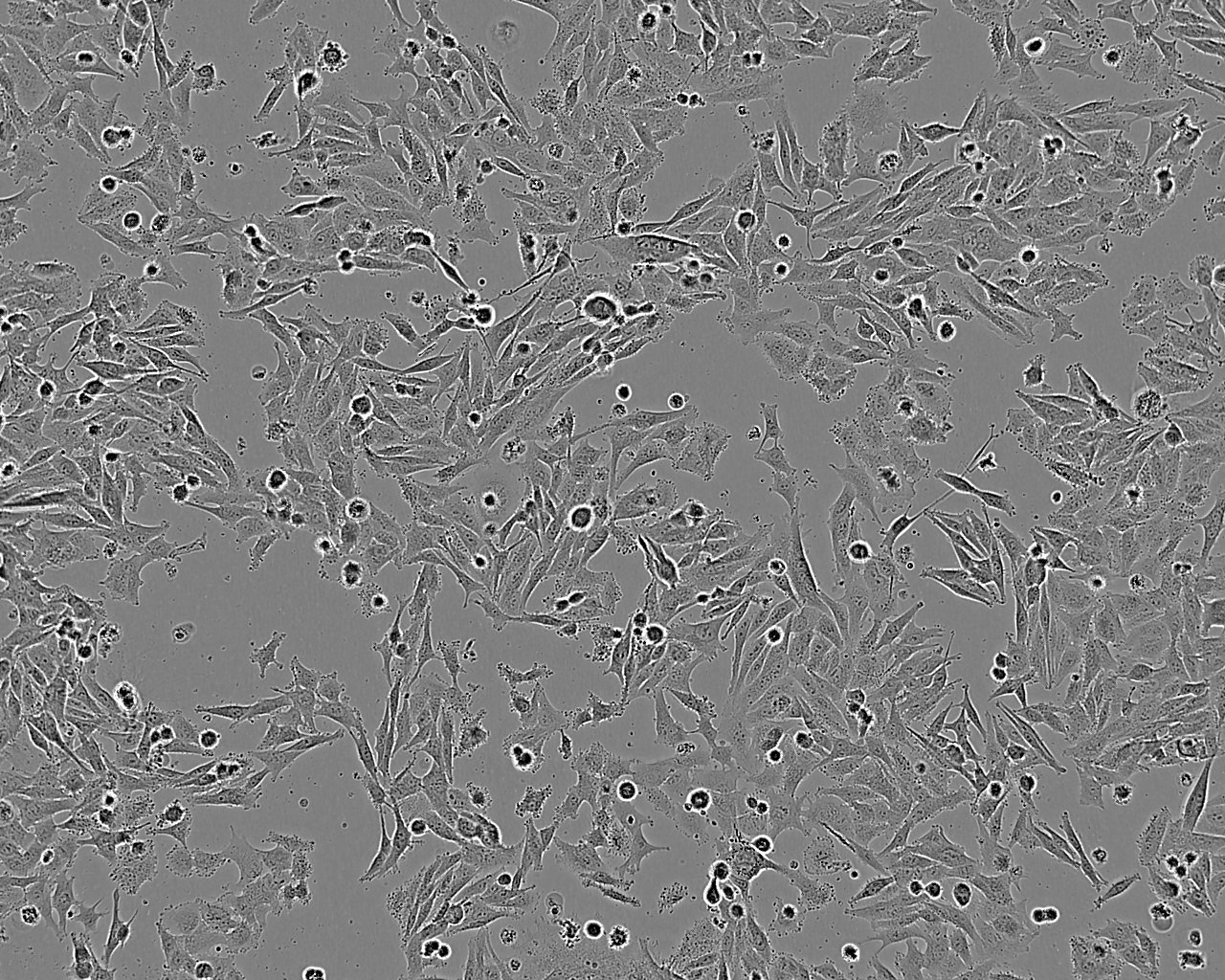 NCI-H1694 epithelioid cells人小细胞肺癌细胞系