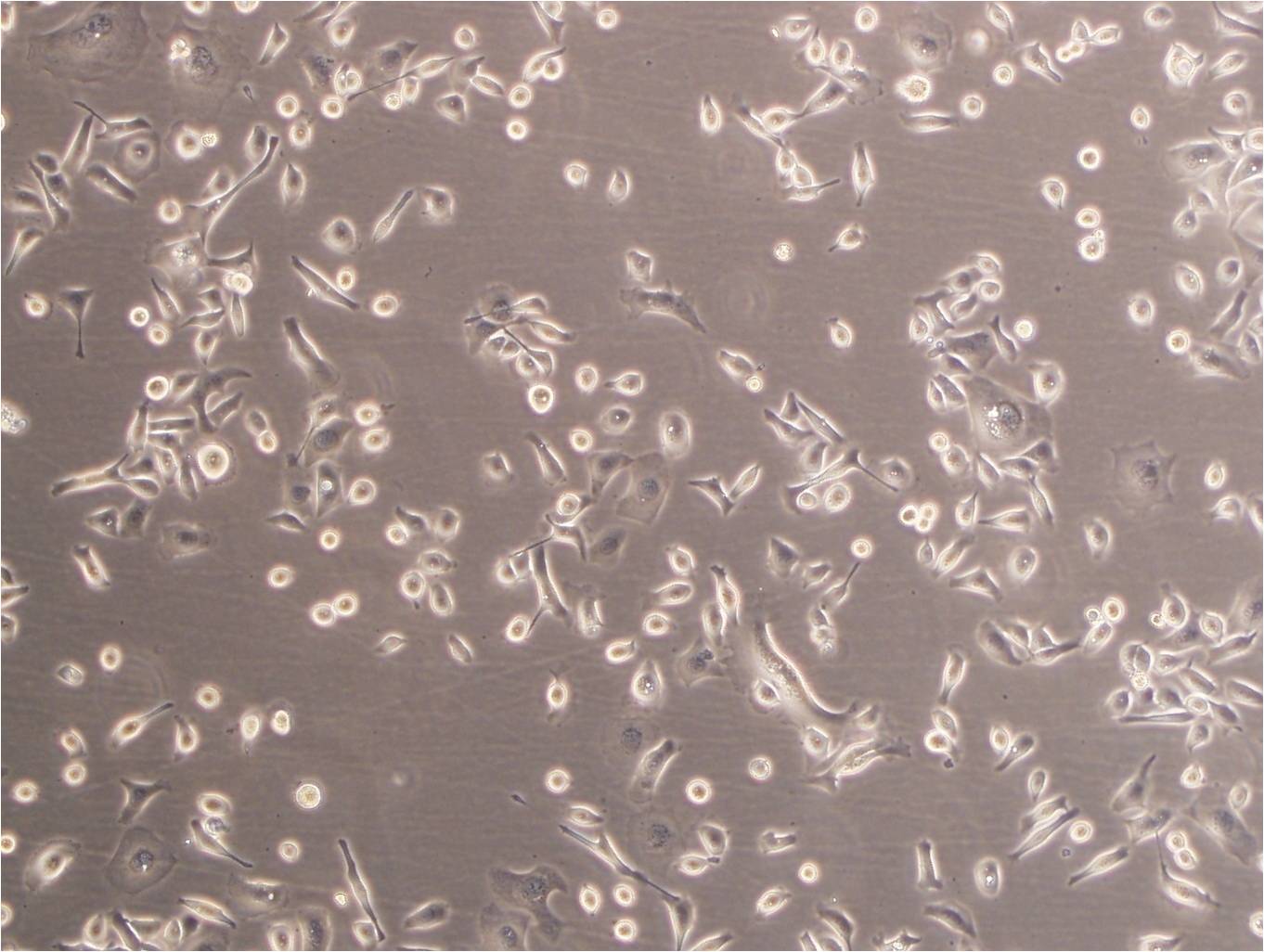 NCI-H2081 epithelioid cells人小细胞肺癌细胞系