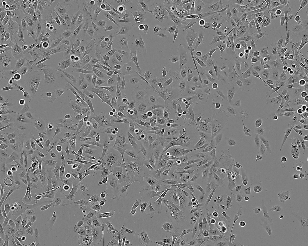 COV504 epithelioid cells人卵巢癌细胞系