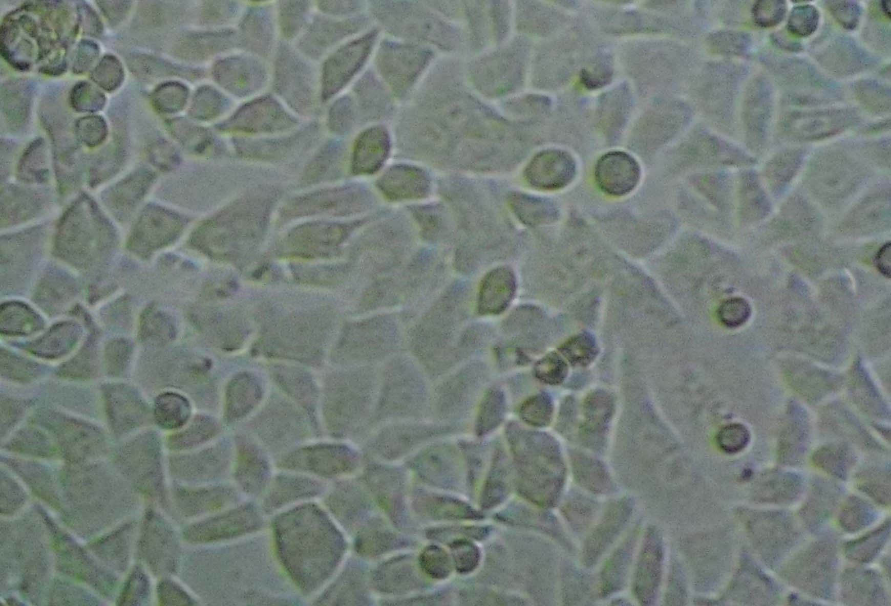 Caov-3 epithelioid cells人卵巢癌细胞系