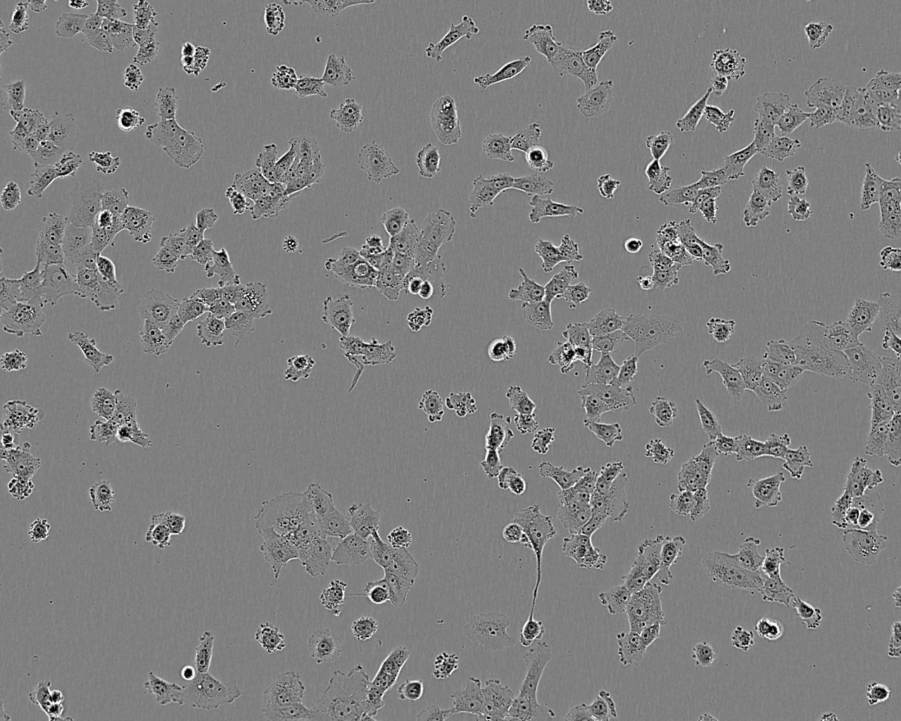 COLO 680N epithelioid cells人食管鳞状癌细胞系