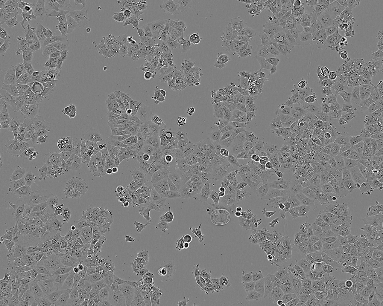 Fao epithelioid cells小鼠肝癌细胞系
