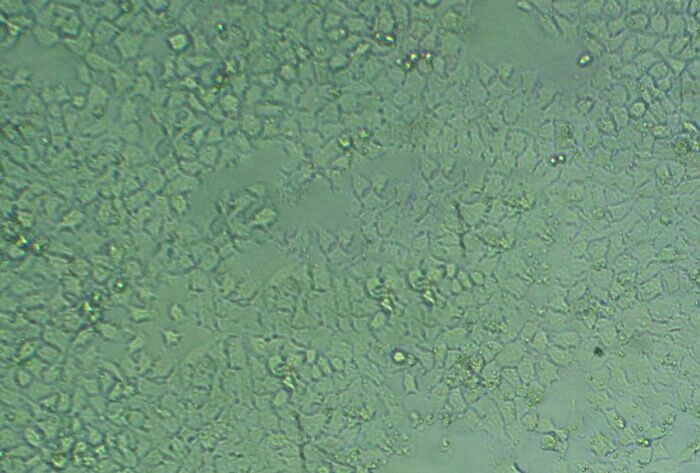 KOSC-2 epithelioid cells人口腔鳞状癌细胞系