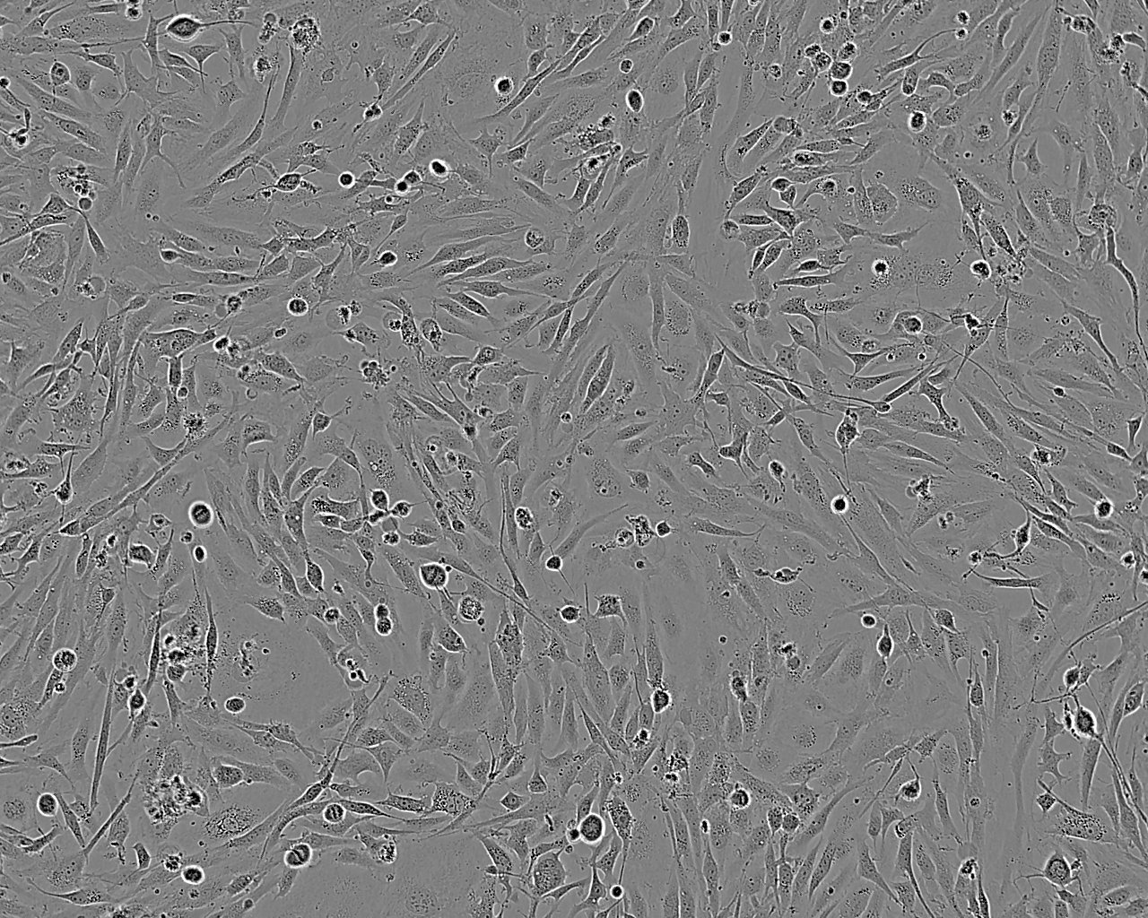 NCI-ADR-RES epithelioid cells卵巢腺癌细胞系