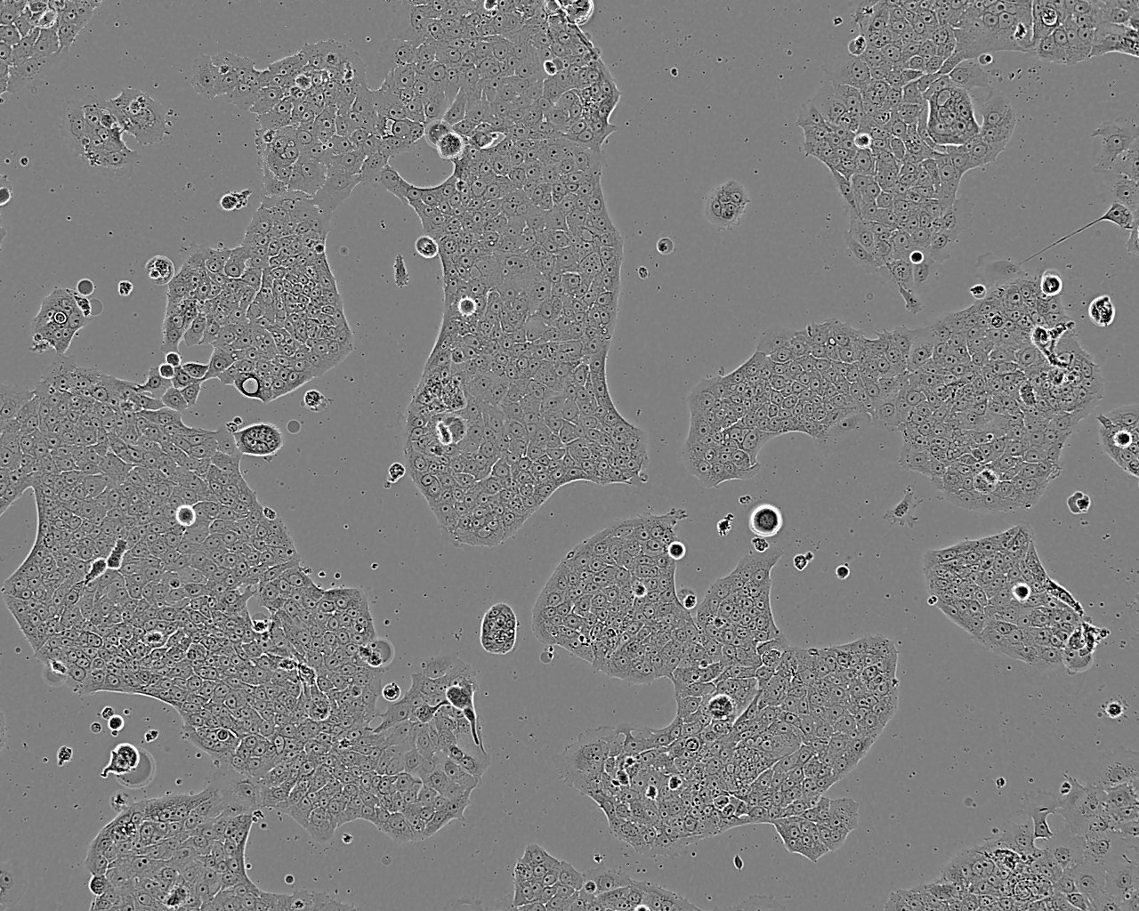 OVCAR-3 epithelioid cells人卵巢腺癌细胞系
