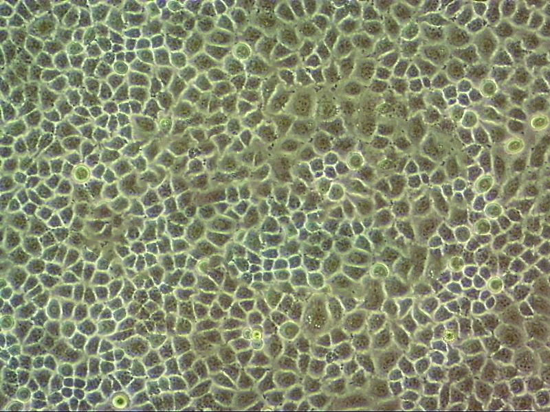 SAS epithelioid cells人舌鳞状细胞癌细胞系