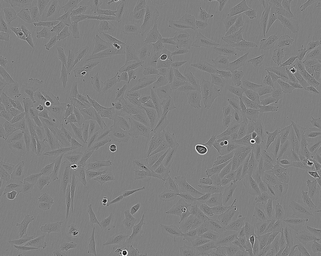 SN12C epithelioid cells人宫颈癌细胞系