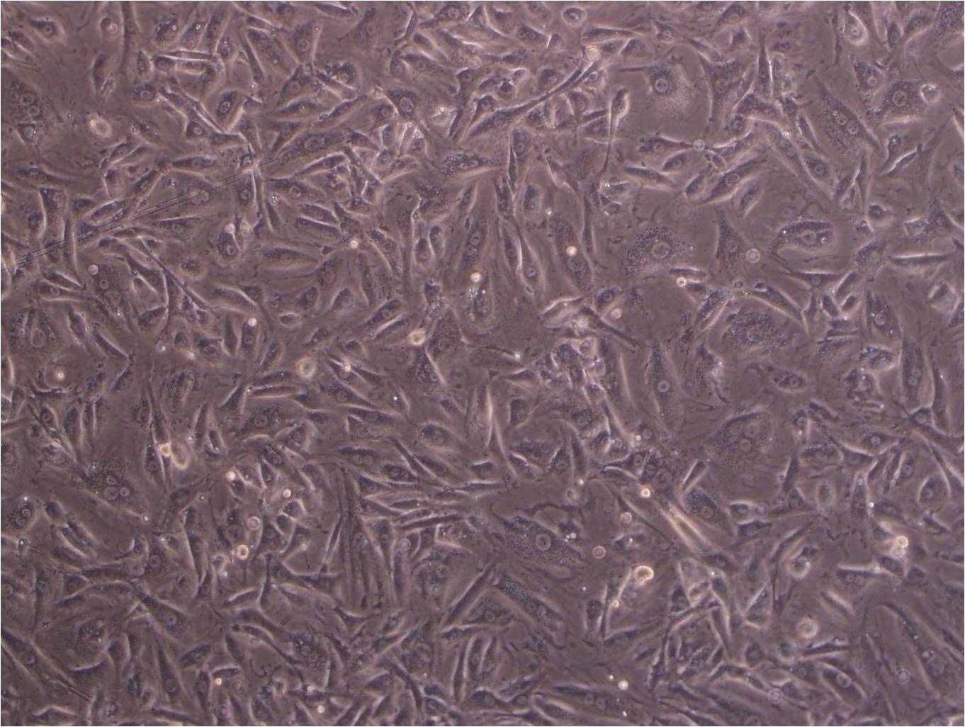 TE-14 epithelioid cells人食管癌细胞系