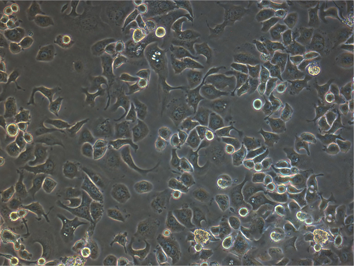 TE-5 epithelioid cells人食管癌细胞系