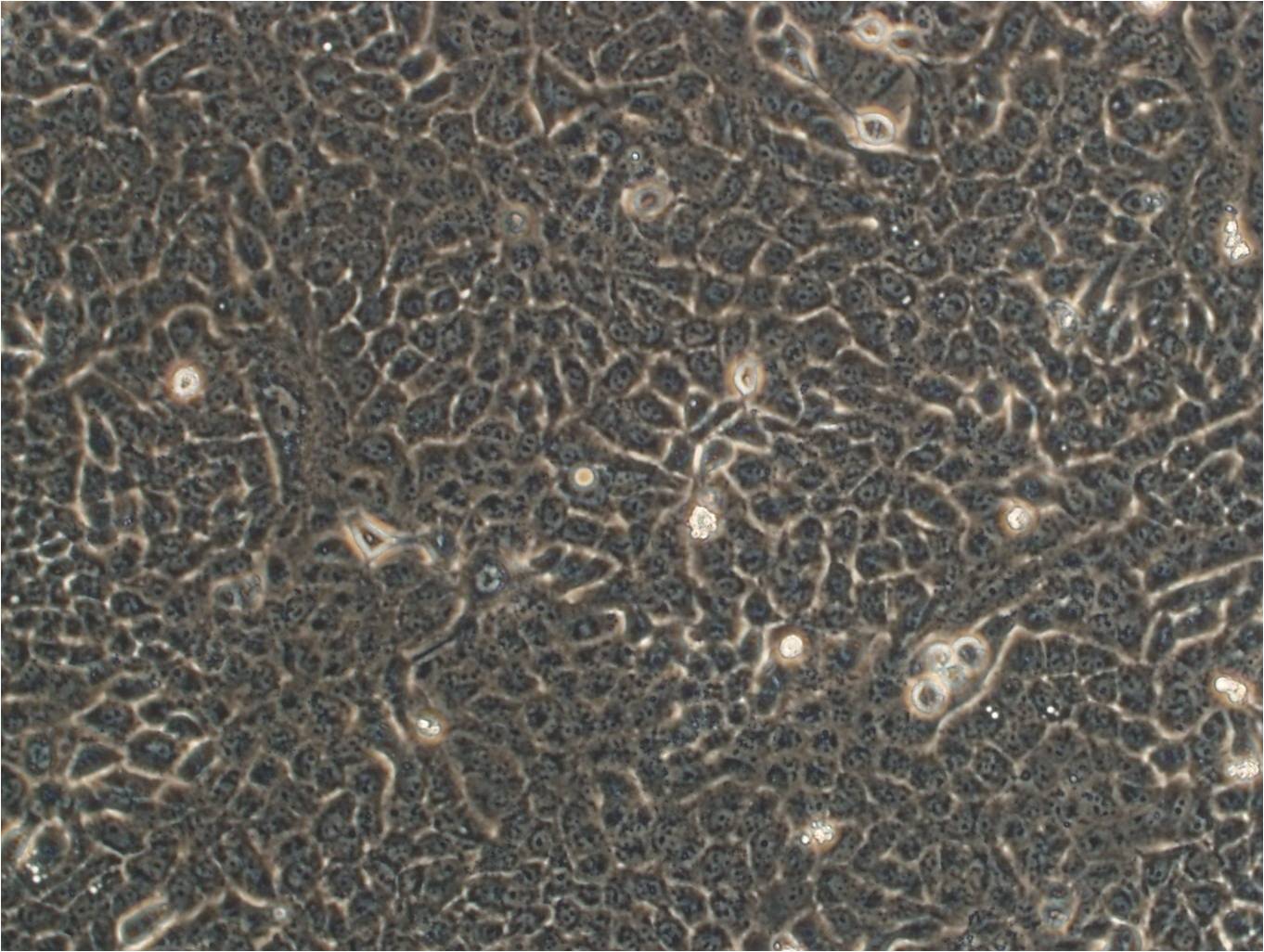 HBE135-E6E7 epithelioid cells人支气管上皮细胞系