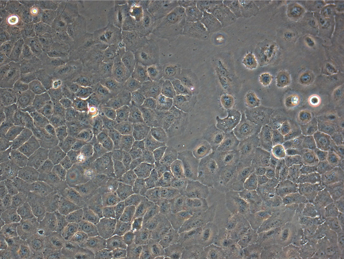 HB611 epithelioid cells人肝母细胞癌细胞系