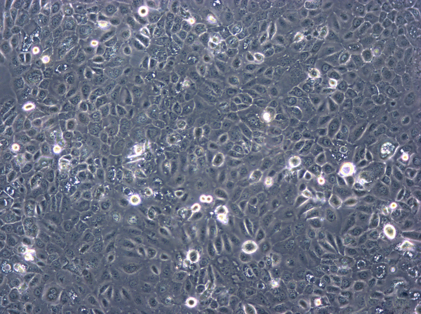 COLO 320DM epithelioid cells人结直肠腺癌细胞系