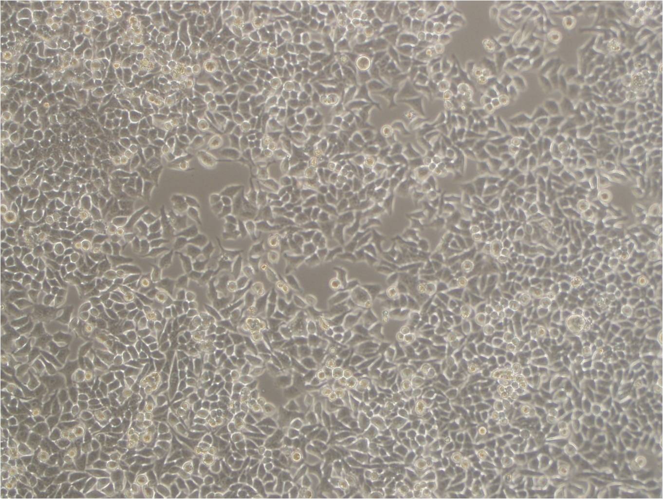 NPC-TW01 epithelioid cells人鼻咽癌细胞系