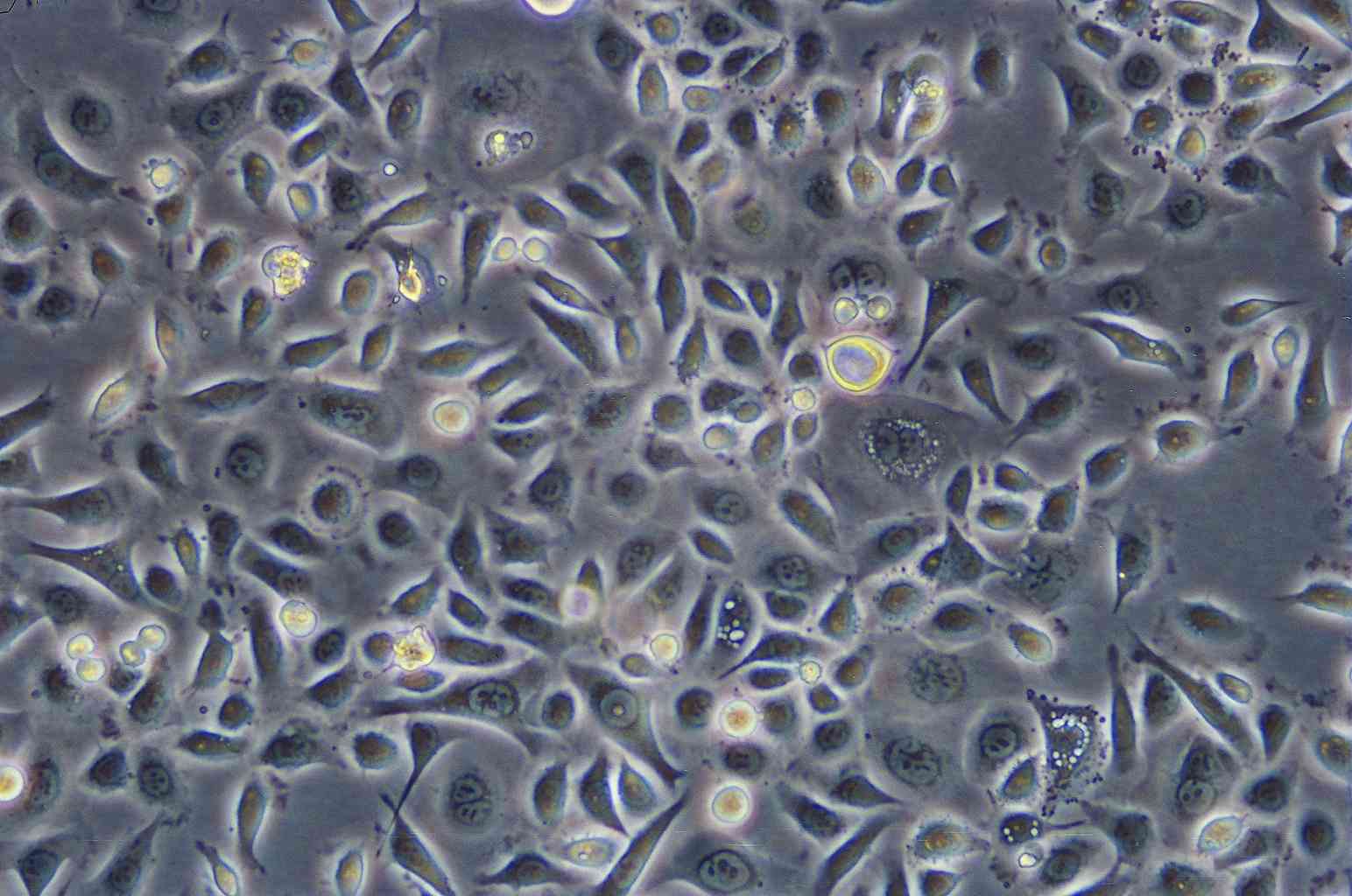 MOLP-2 epithelioid cells人多发性骨髓瘤细胞系