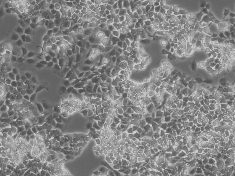 IAR 20 epithelioid cells大鼠肝细胞系
