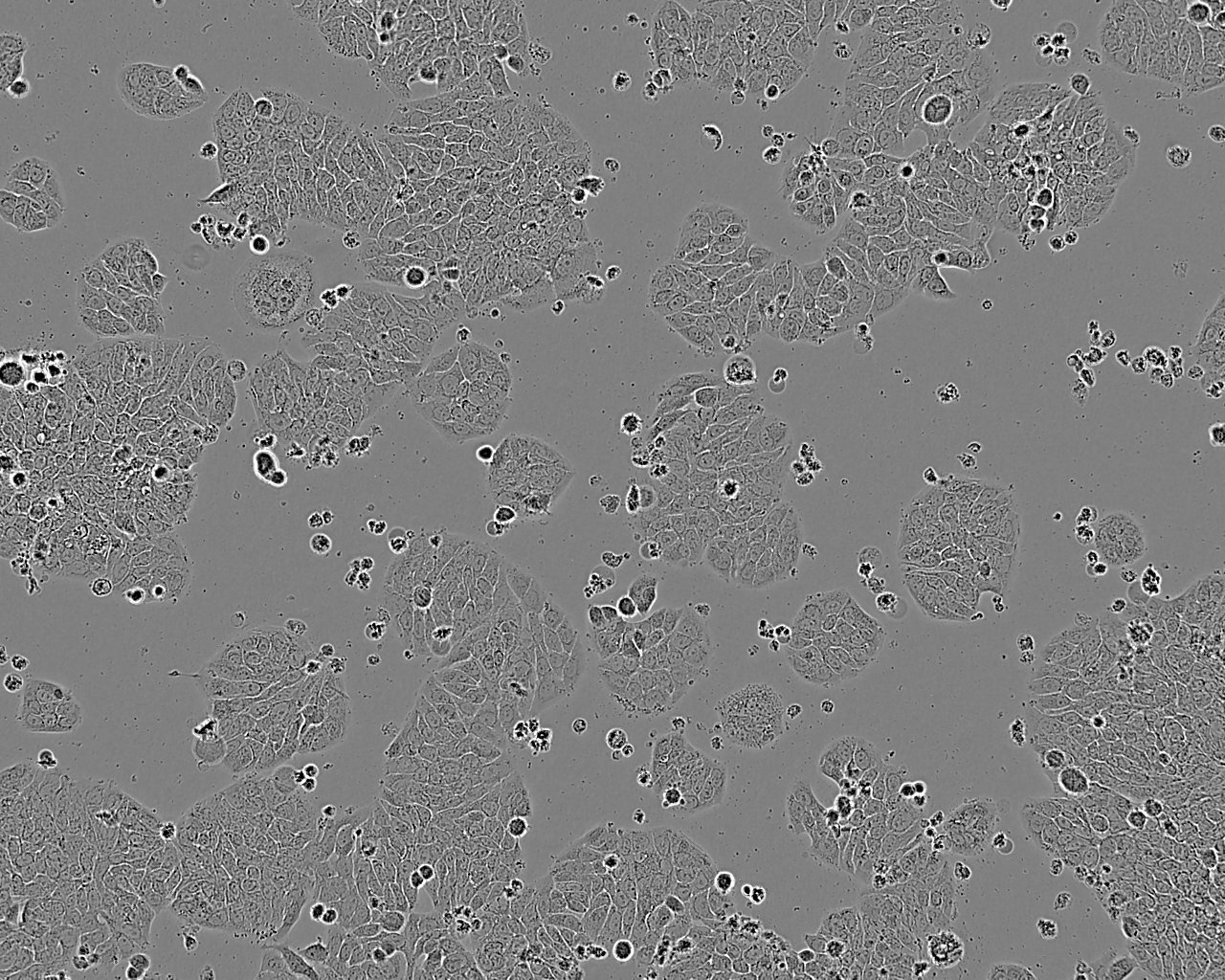 Tu 177 epithelioid cells人喉鳞癌细胞系