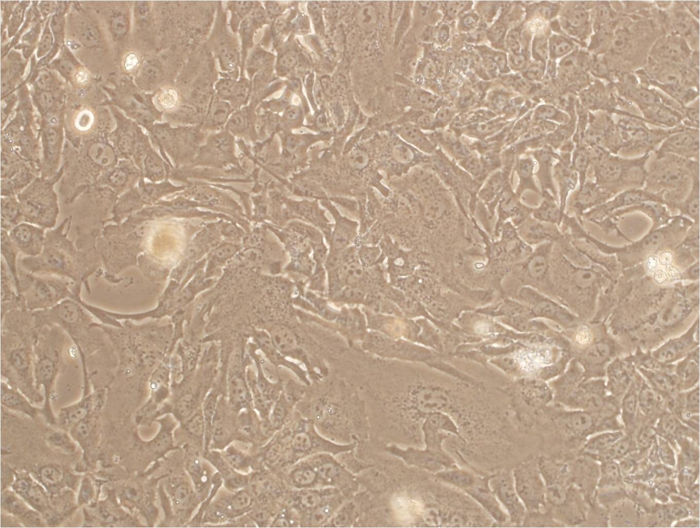OVTOKO epithelioid cells人卵巢透明细胞癌细胞系