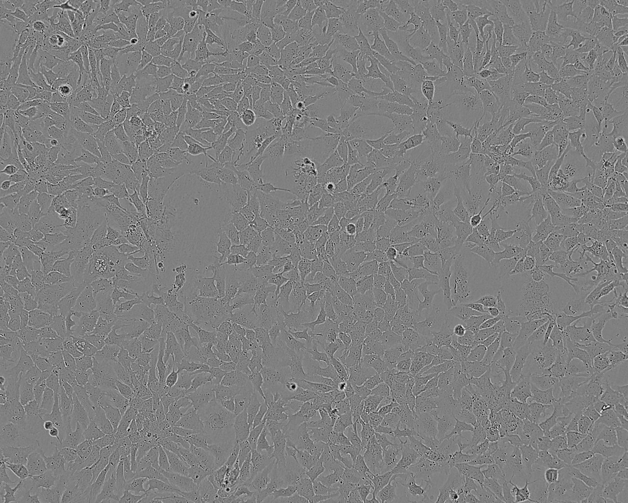 QGP-1 epithelioid cells人胰腺癌细胞系