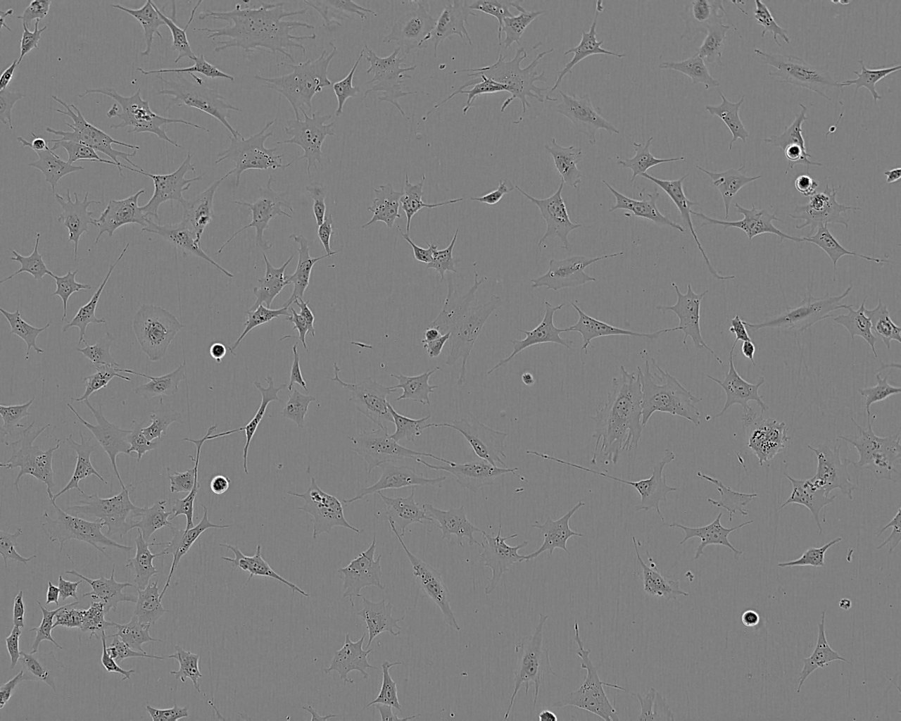 MUG-Chor1 epithelioid cells人骶骨脊索瘤细胞系