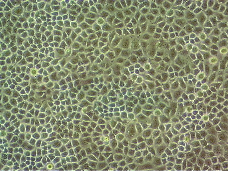 T-HEECs epithelioid cells人正常食管上皮细胞系