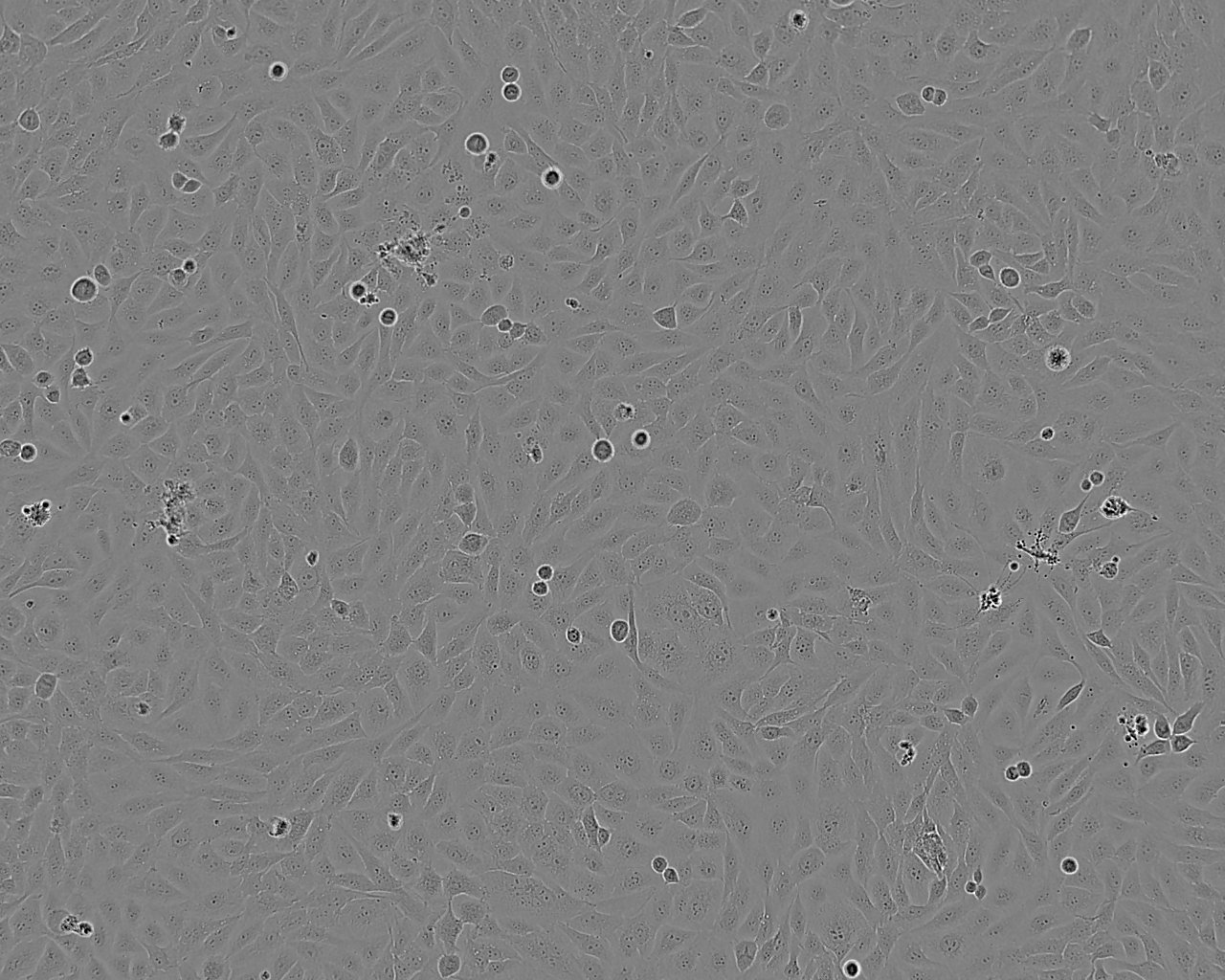 hTERT-RPE1 epithelioid cells人视网膜色素上皮细胞系
