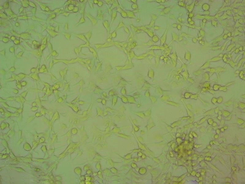 CAL-39 epithelioid cells人外阴鳞癌细胞系