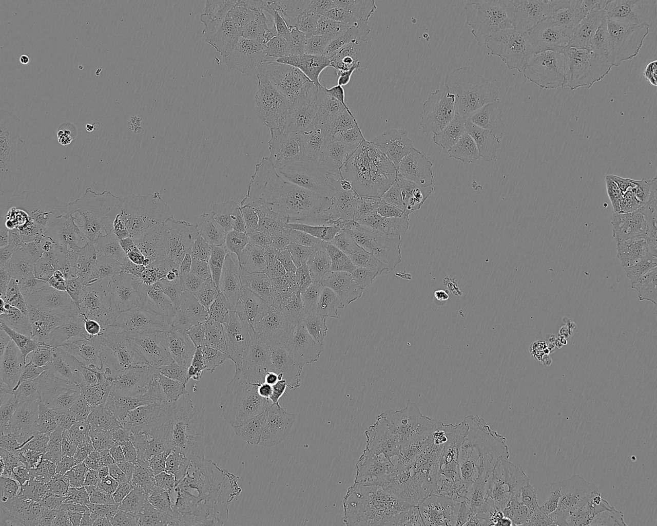 Hs 578Bst epithelioid cells人正常乳腺细胞系