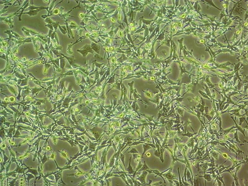 C-4-I epithelioid cells人宫颈癌细胞系