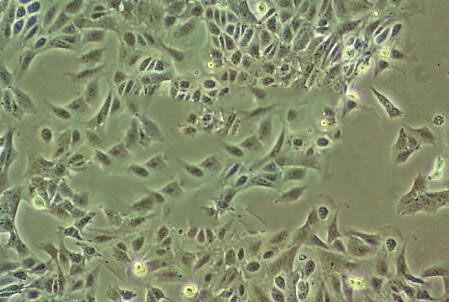 Mahlavu epithelioid cells人肝癌细胞系