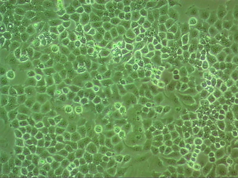 TCMK-1 epithelioid cells小鼠肾小管上皮细胞系