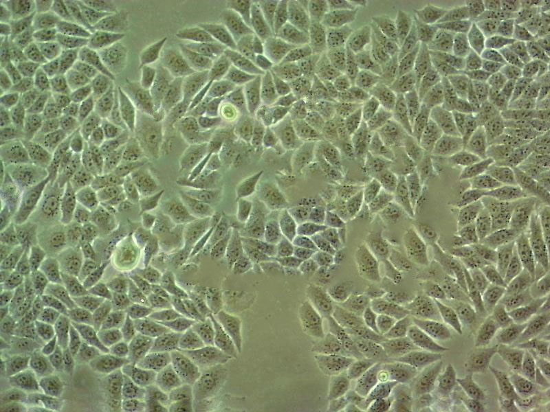 KYSE-180 epithelioid cells人食管鳞癌细胞系