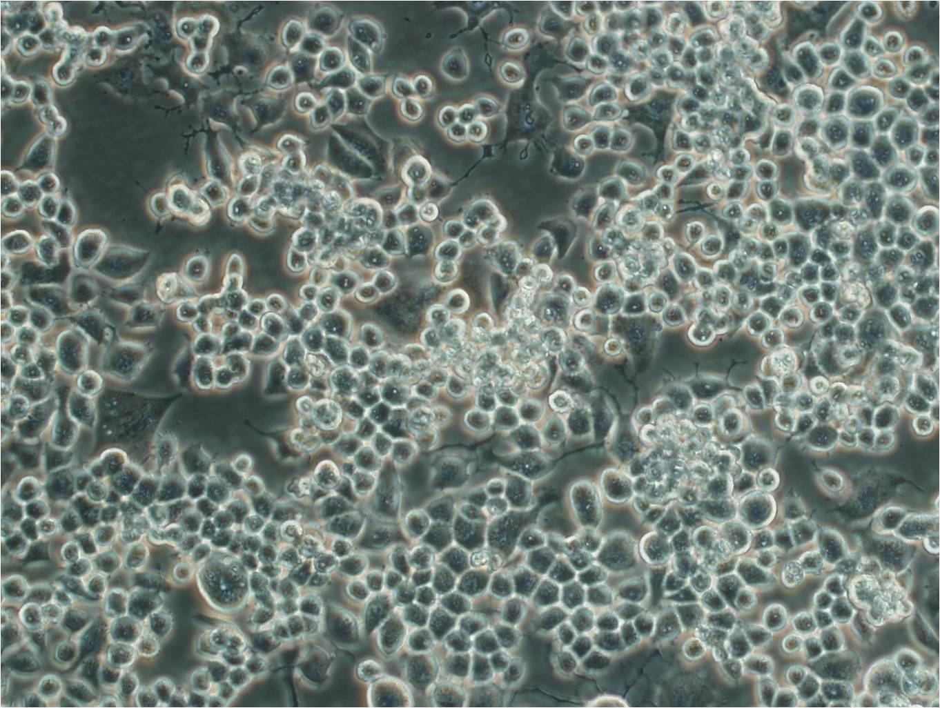 Ect1/E6E7 epithelioid cells人宫颈永生化鳞状细胞系