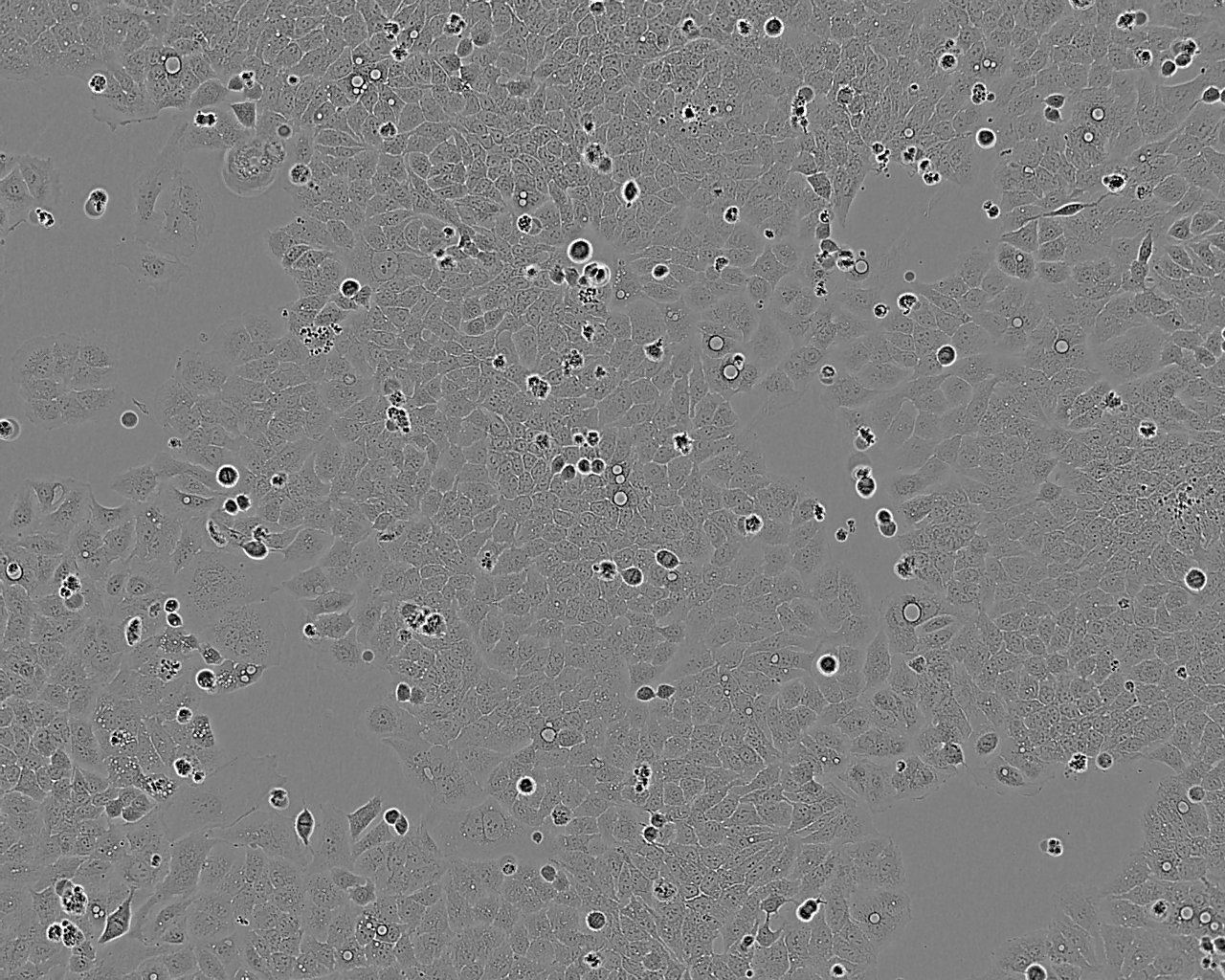 HSC-1 epithelioid cells人皮肤鳞癌细胞系