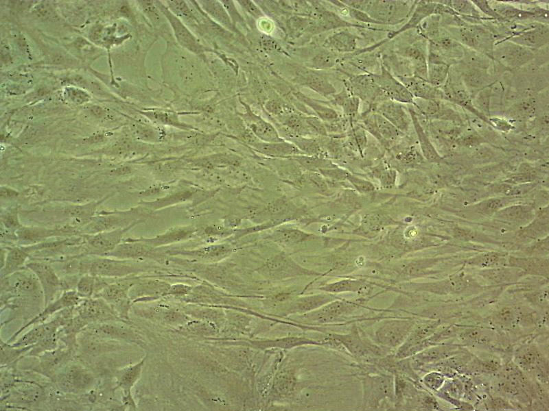 WML2 fibroblast cells小鼠肺成纤维细胞系