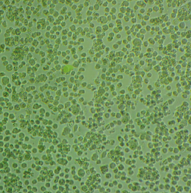 MT-4 Lymphoblastoid cells人急性淋巴母细胞白血病细胞系