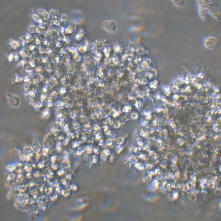 BALL-1 Lymphoblastoid cells人B淋巴细胞急性白血病细胞系