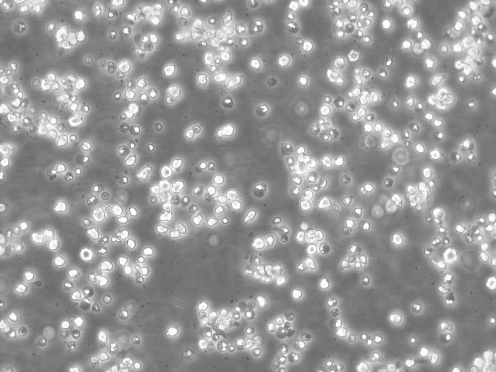 SUP-T1 Lymphoblastoid cells人淋巴母细胞淋巴瘤细胞系