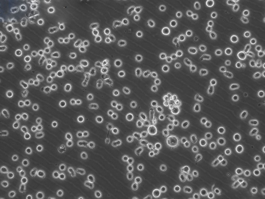 HH [Human lymphoma] Lymphoblastoid cells人皮肤T淋巴细胞瘤细胞系