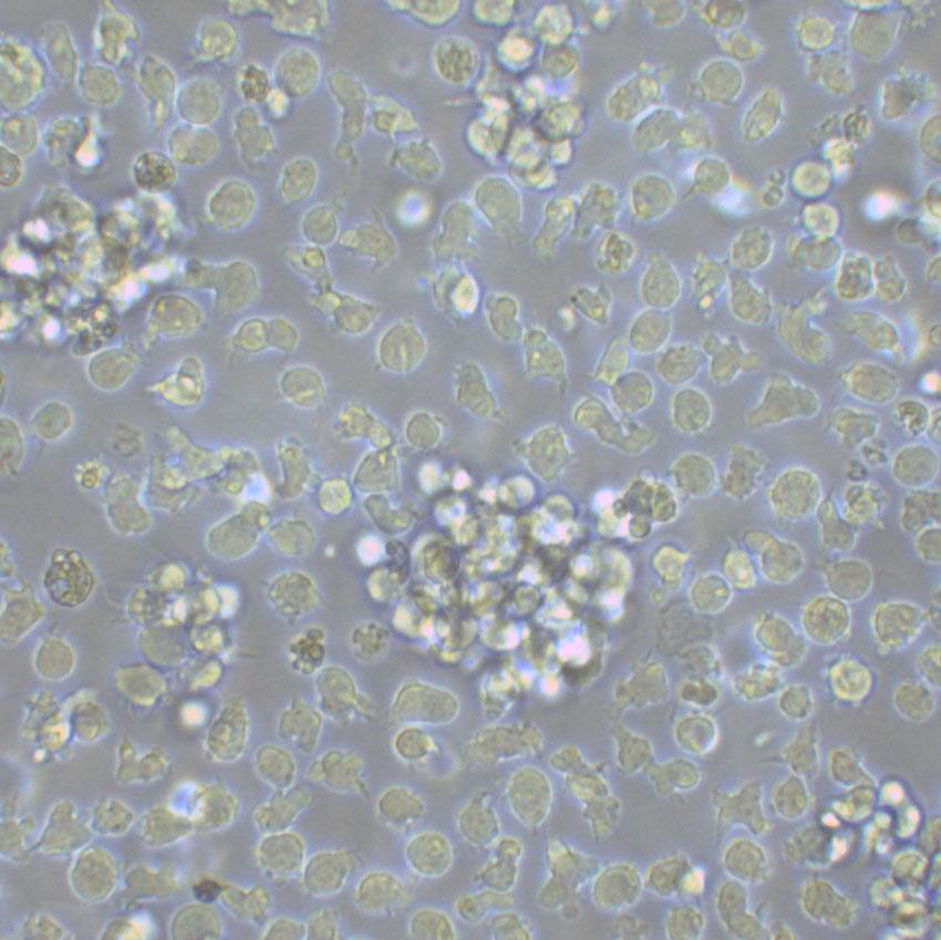 HuT 102 Lymphoblastoid cells人T淋巴瘤细胞系