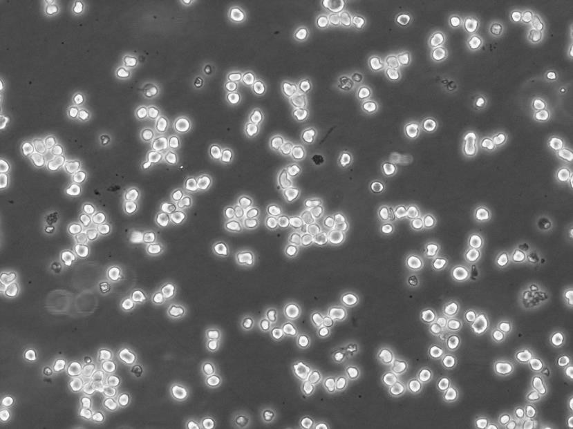 Cates-1B Lymphoblastoid cells人睾丸淋巴胚胎性癌细胞系