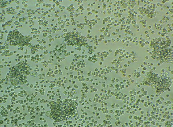 SU-DHL-5 Lymphoblastoid cells人弥漫大D细胞系