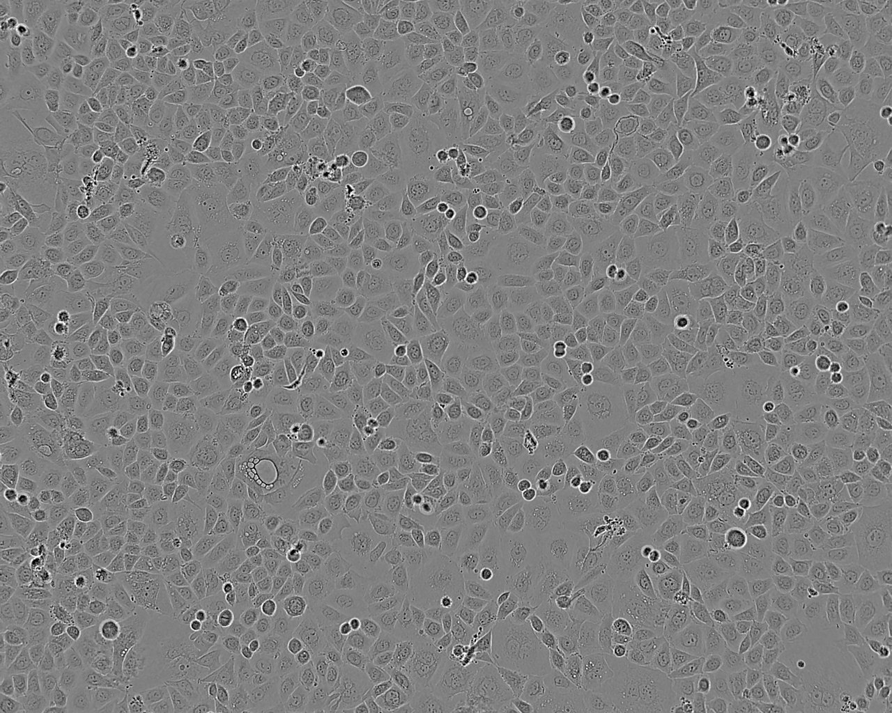 Caki-1 Adherent人肾透明细胞癌细胞系