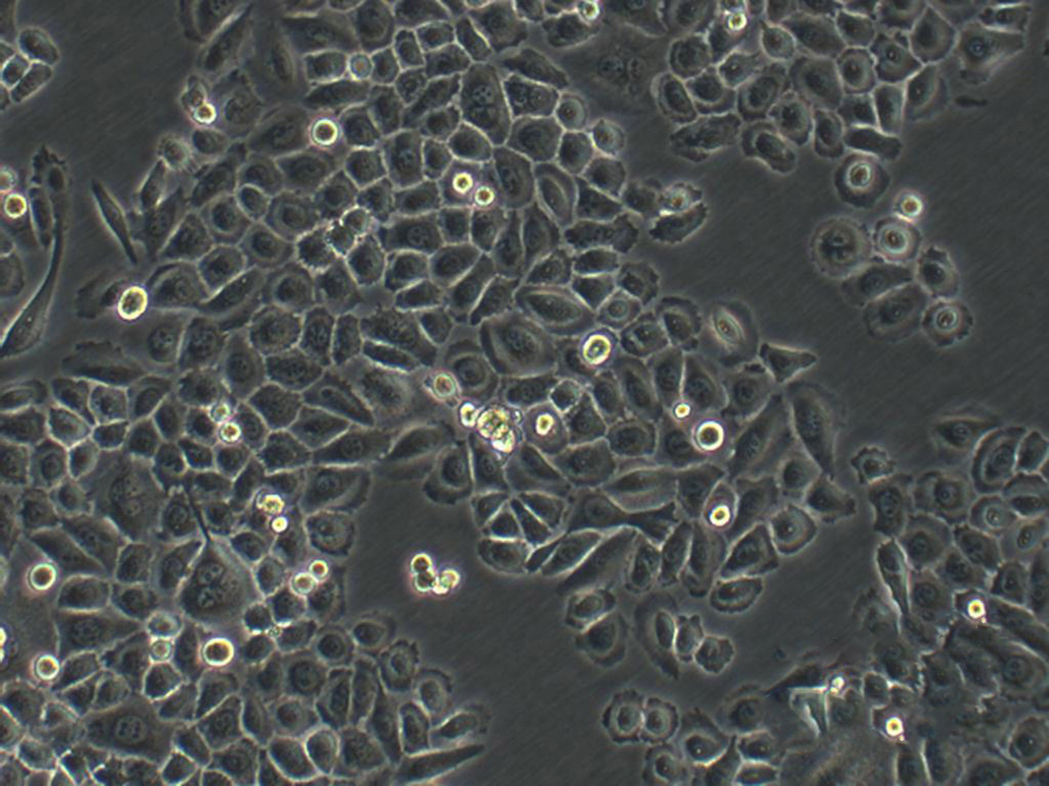 GB-1 Adherent人脑胶质母细胞瘤细胞系