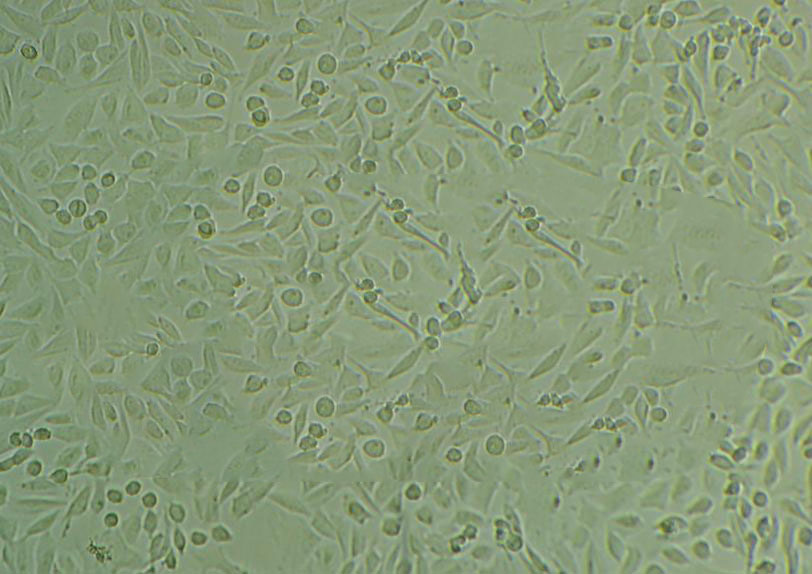 NCI-H920 epithelioid cells人肺癌细胞系