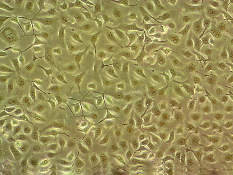 NCI-H2081 Adherent人小细胞肺癌细胞系