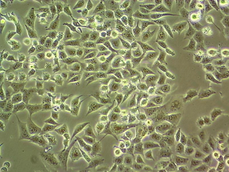 NCM356 Adherent结直肠腺癌细胞系