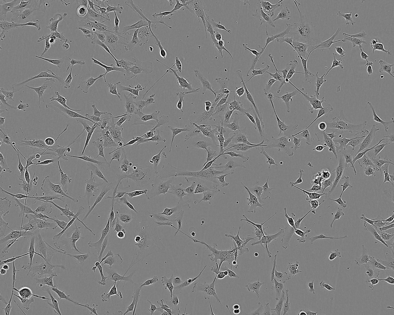 SN12C Adherent人宫颈癌细胞系