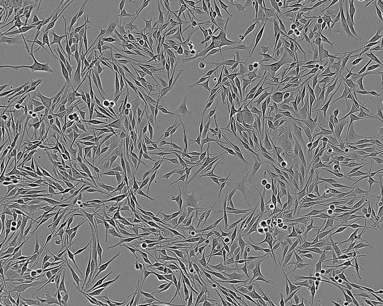 HTR-8/SVneo Adherent人绒毛膜滋养层细胞系