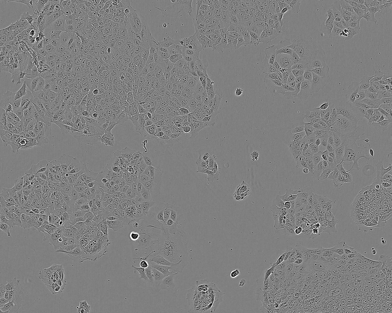 HRA-19 epithelioid cells人结肠癌腺癌细胞系