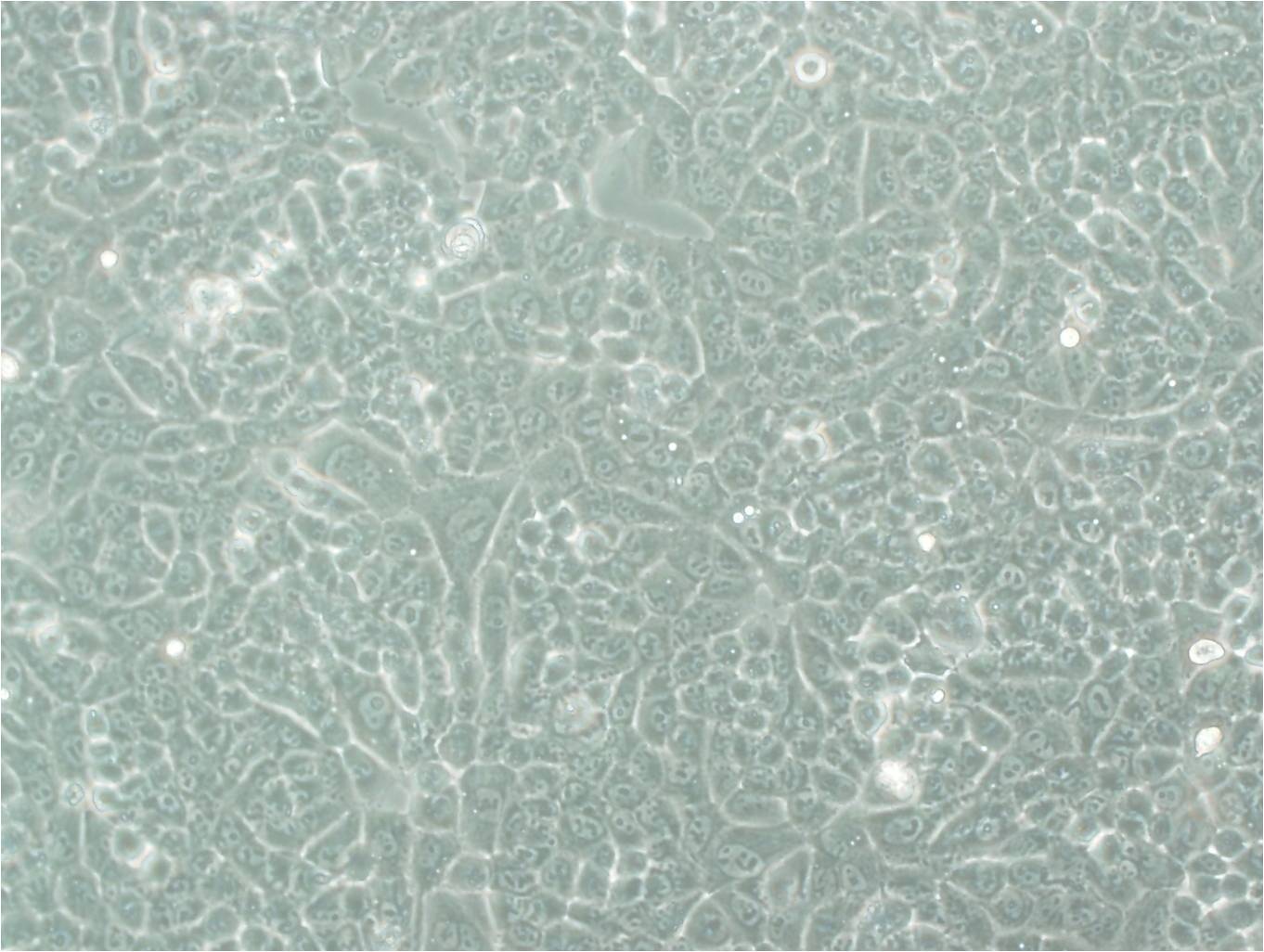 VP303 epithelioid cells人乳腺癌细胞系